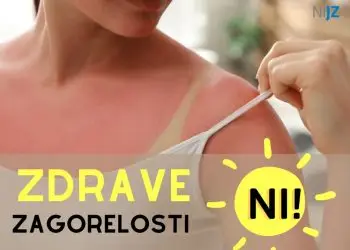 Zdrave zagorelosti ni