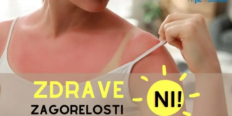 Zdrave zagorelosti ni